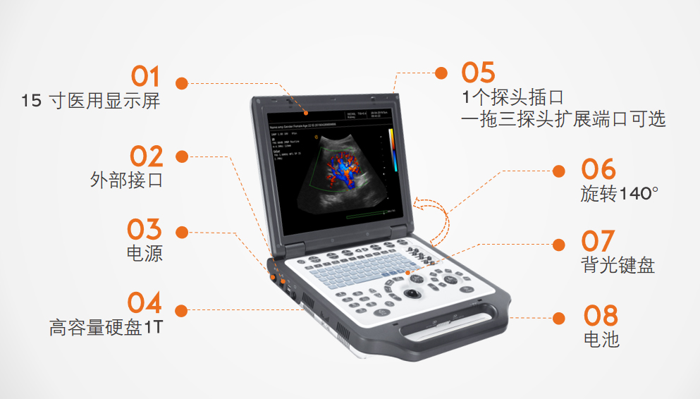 多普勒彩超机整机概况